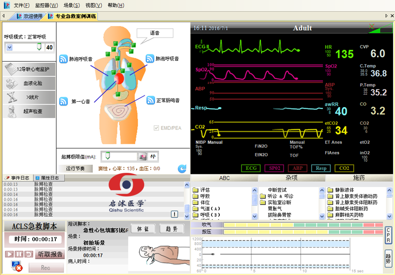  高智能數(shù)字化綜合急救技能訓(xùn)練系統(tǒng)（ACLS高級生命支持、計(jì)算機(jī)軟件控制）
