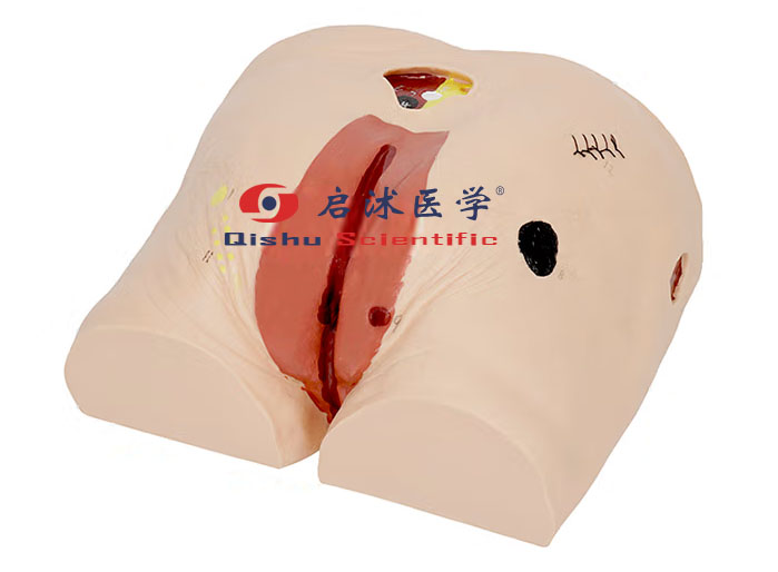 高級(jí)褥（壓）瘡護(hù)理模型